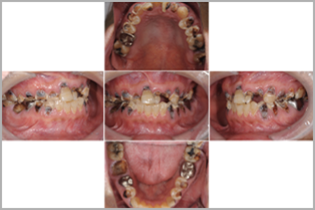 Case 01