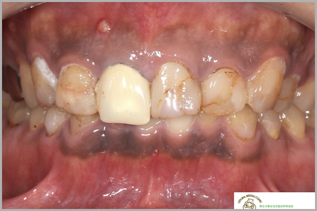 Case 03