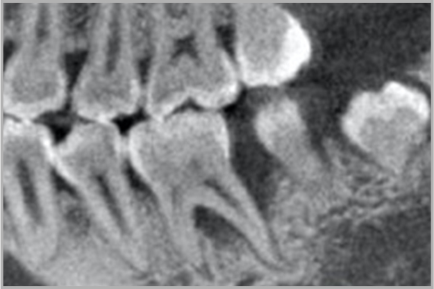 Case 04