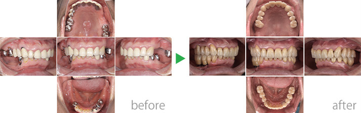 症例3のbefore-after