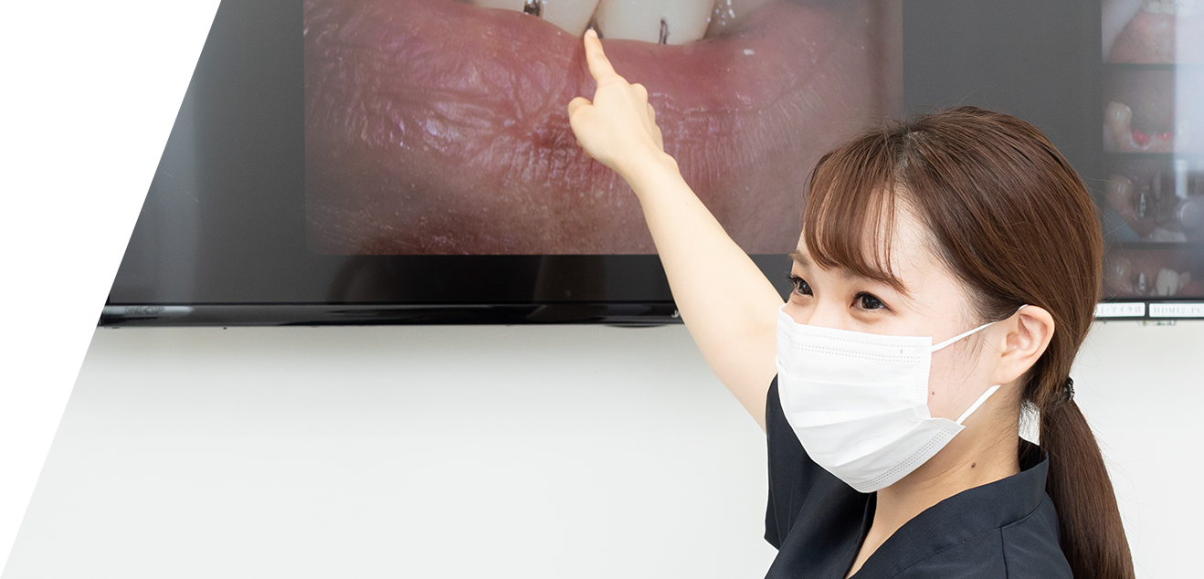 審美セラミック治療