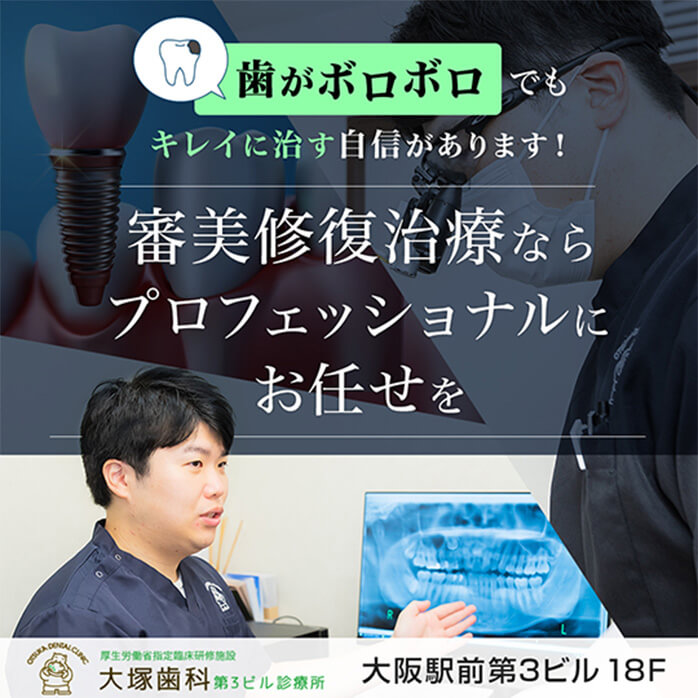 審美修復治療ならプロフェッショナルにお任せを